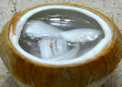 ဆီးေရာဂါ ခံစားေနရသူမ်ားအတြက္ အစြမ္းထက္တဲ႔ အုန္းသီးႏု